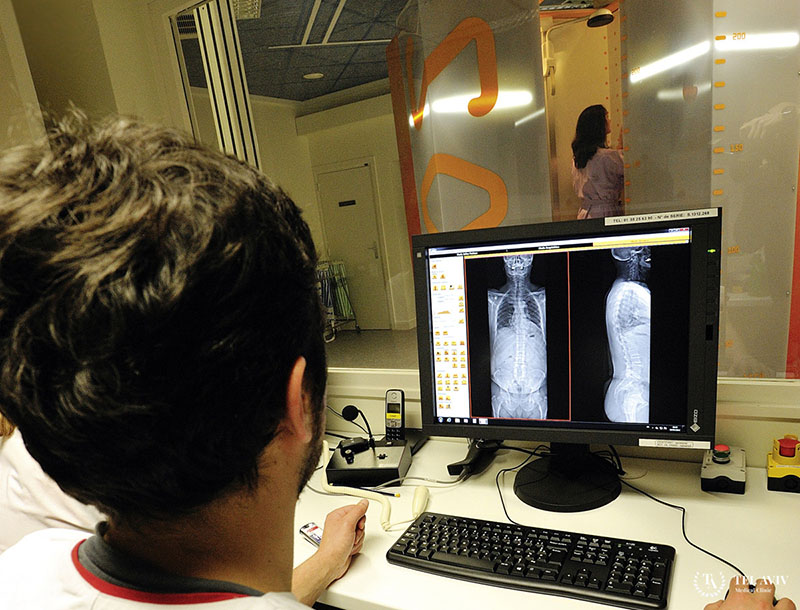 МРТ спинного мозга ребенку