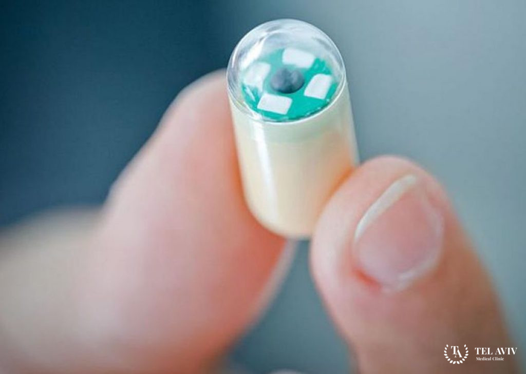 Видеокапсульная эндоскопия