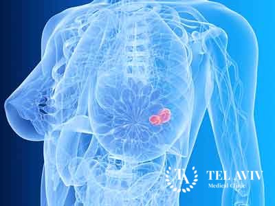 Симптомы заболевания молочной железы