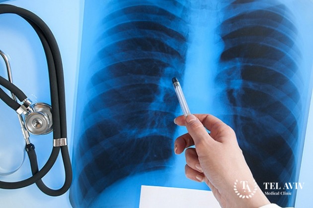 Пульмонологи - что они лечат?