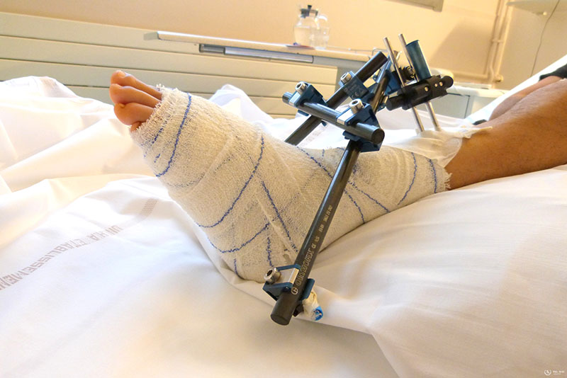 Симптоматика ревматических заболеваний