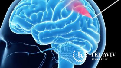 Диагностика путем биопсии головного мозга