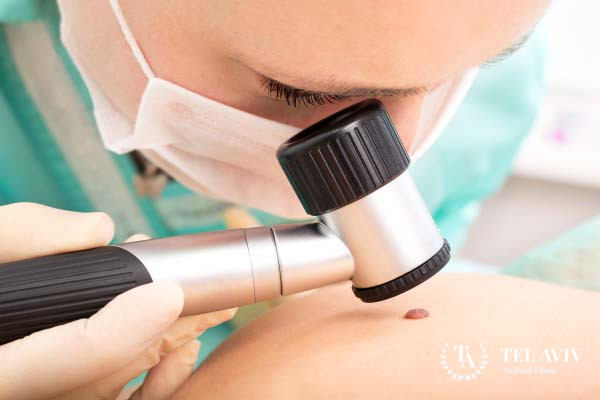 Гломусная опухоль