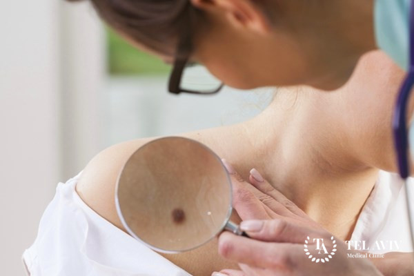 Эпителиоидная гемангиоэндотелиома – симптомы, лечение