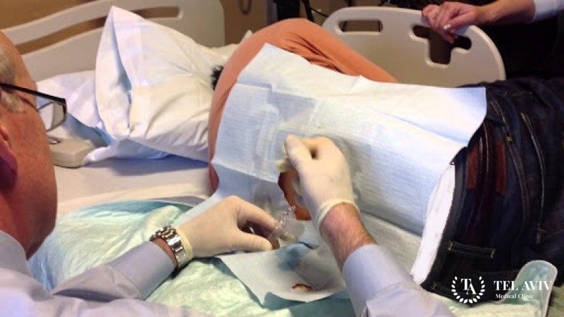 Биопсия позвоночника