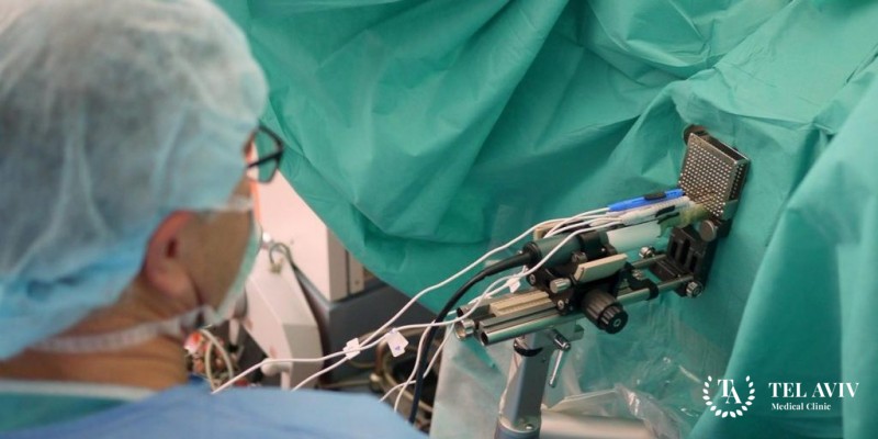 Технология «Нано-нож» - вся информация