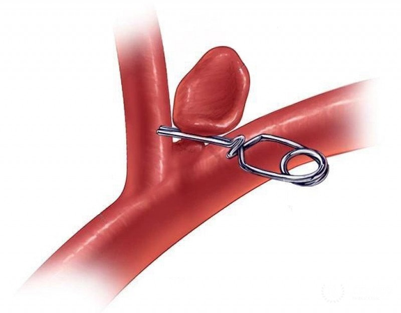 Клипирование - вся информация