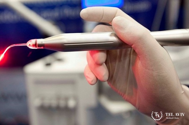 Фотодинамическая терапия в гинекологии (ФДТ)