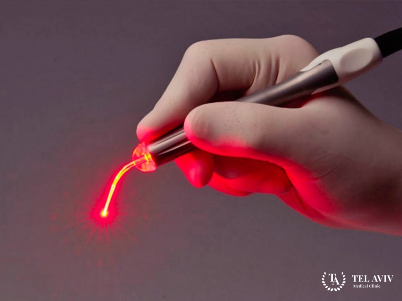 Фотодинамическая терапия влагалища