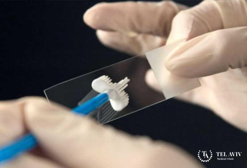 Цитологический мазок (pap smear test)