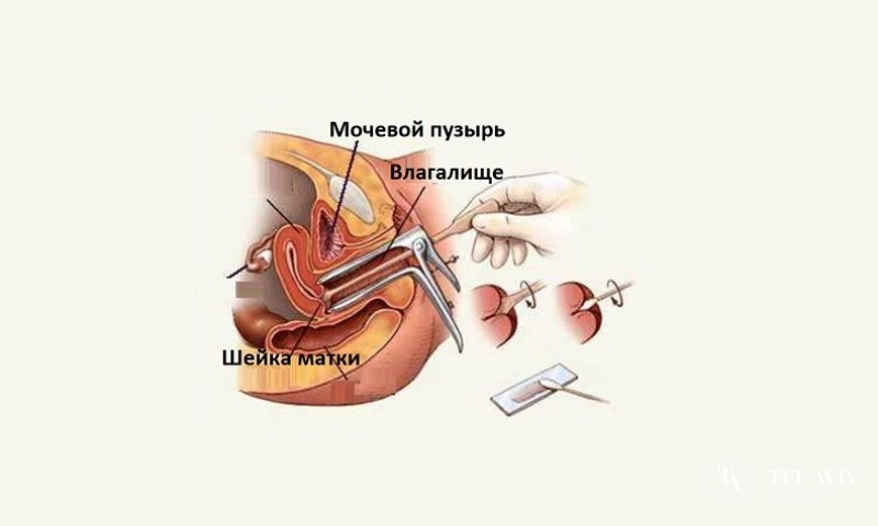 Биопсия вульвы: показания, подготовка, противопоказания