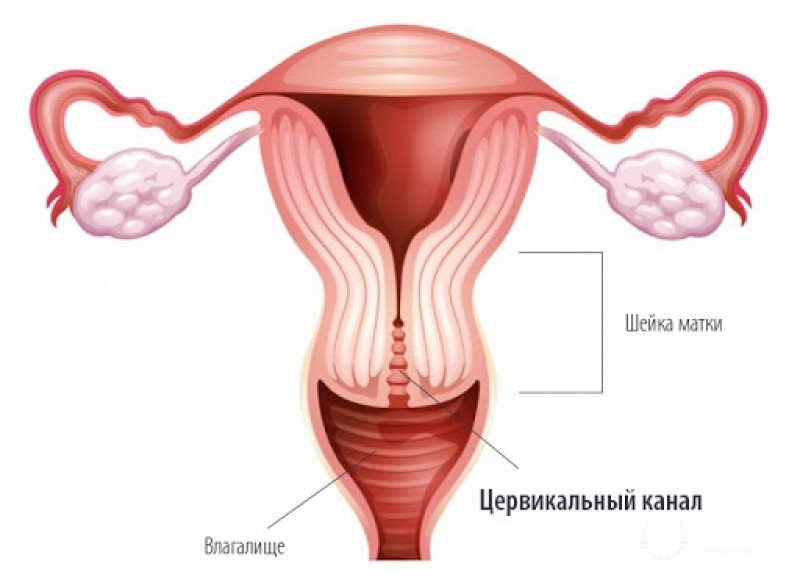 Меланосаркома влагалища - информация про заболевание