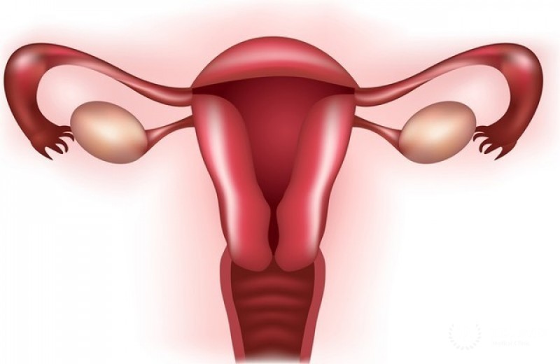 Фибросаркома влагалища - полная информация