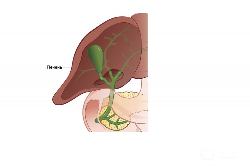 Тирозинемия тип I