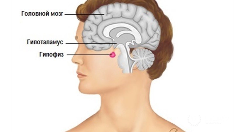 Опухоли аденомы гипофиза