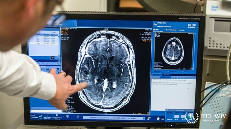 Дизэмбриогенетические опухоли