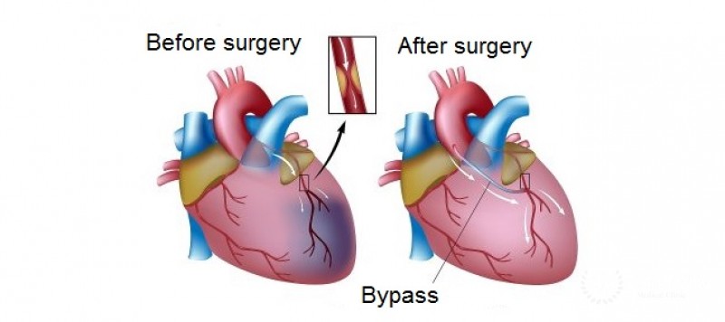 Office of vascular surgery