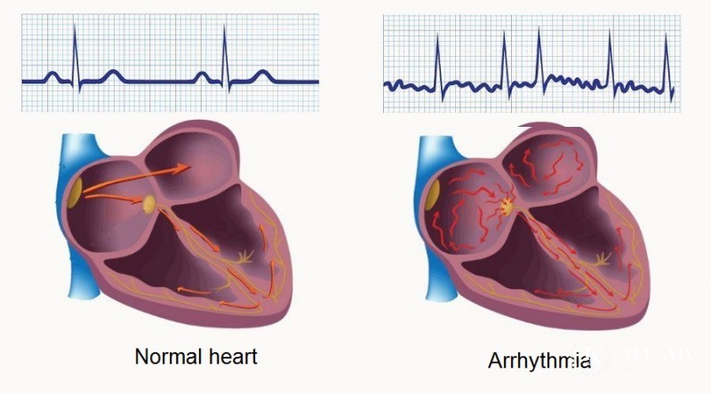 Performed treatment procedures in the department of vascular surgery