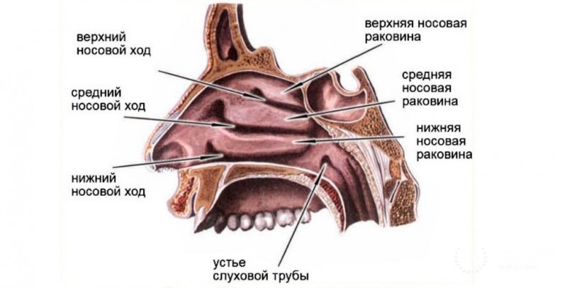 Карцинома полости носа