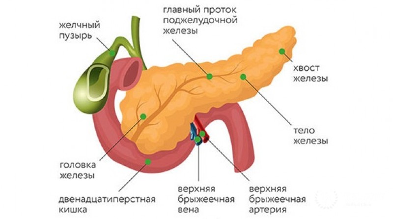 Ацинарно-клеточный рак поджелудочной железы