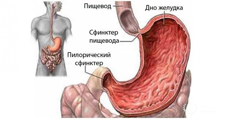 Изъявленная карцинома желудка