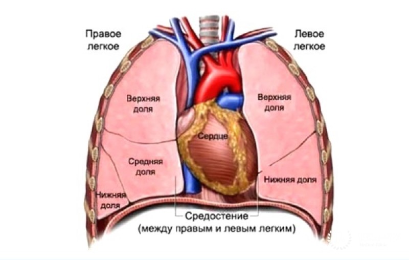 Атипичный карциноид средостения