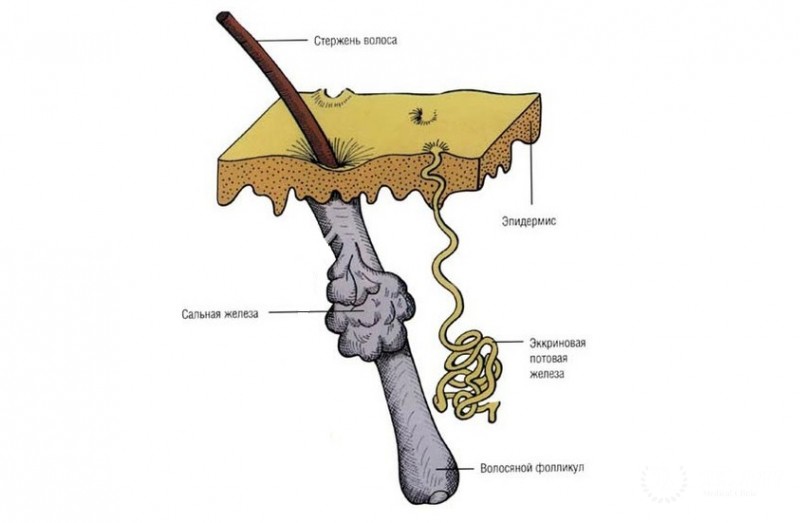 Цилиндрома потовых желез