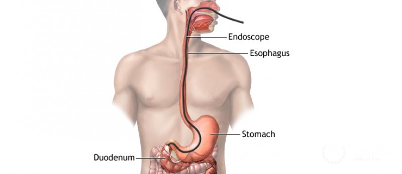 Specialty procedures