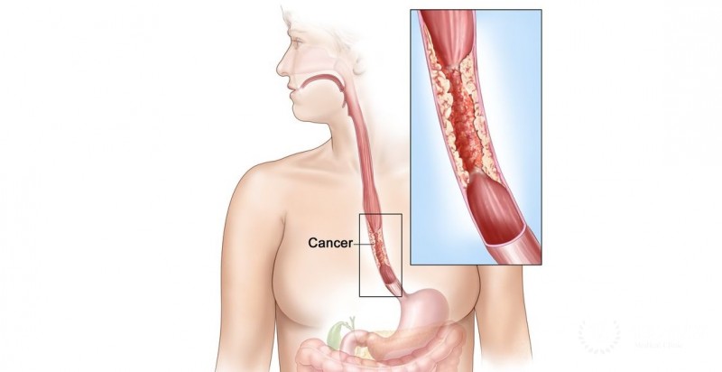 Oncology of the gastrointestinal tract: diagnosis, treatment