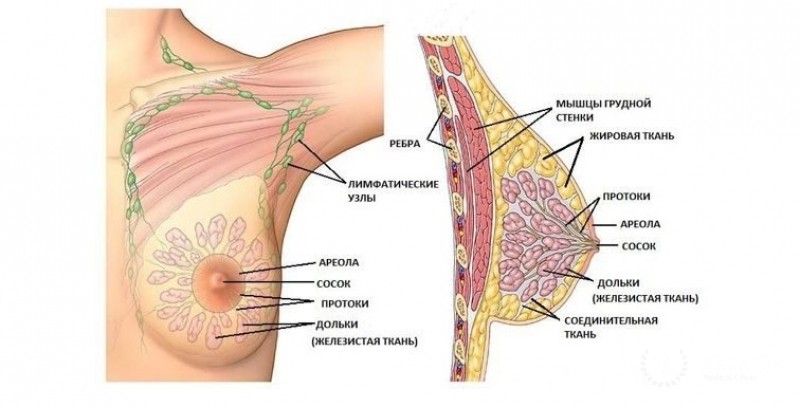 Апокринный рак молочной железы