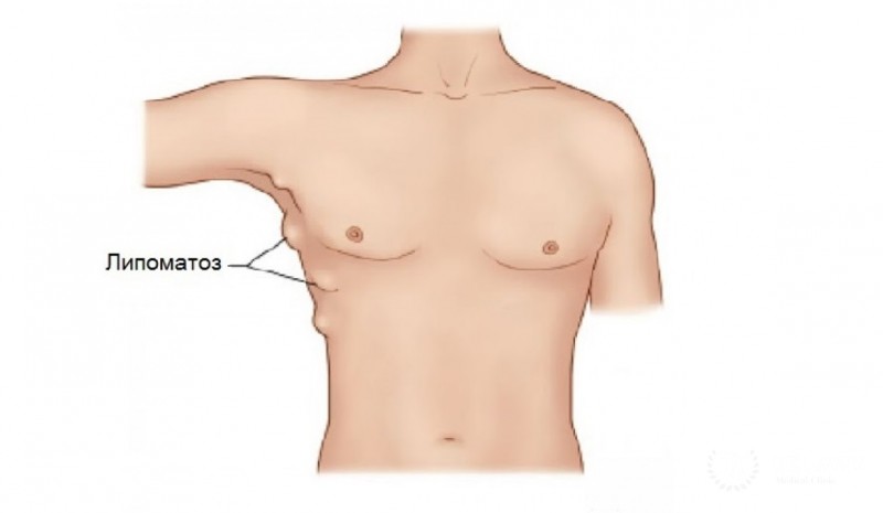 Образование жировой ткани