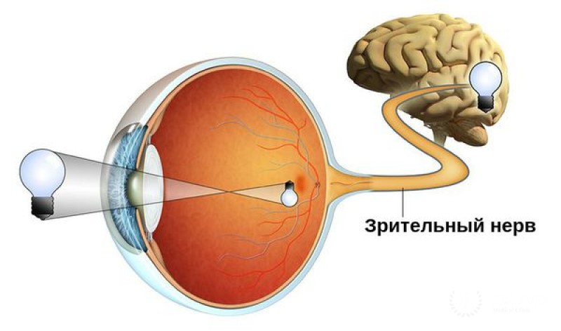 Повреждение зрительного нерва