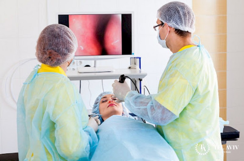 Функциональная эндоскопическая риносинусохирургия (FESS)