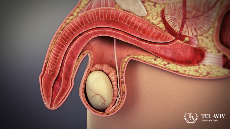 Эректильная дисфункция