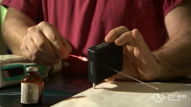 Удаление опухоли предстательной железы с помощью нового метода TOOKAD