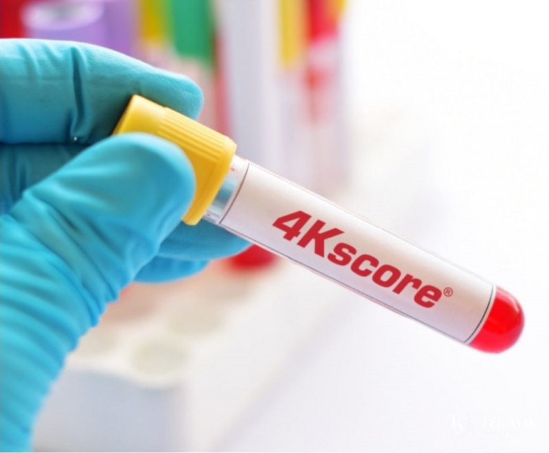 Анализ 4Kscore