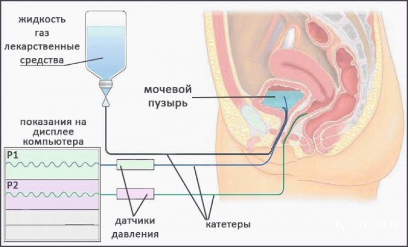 Урофлоуметрия