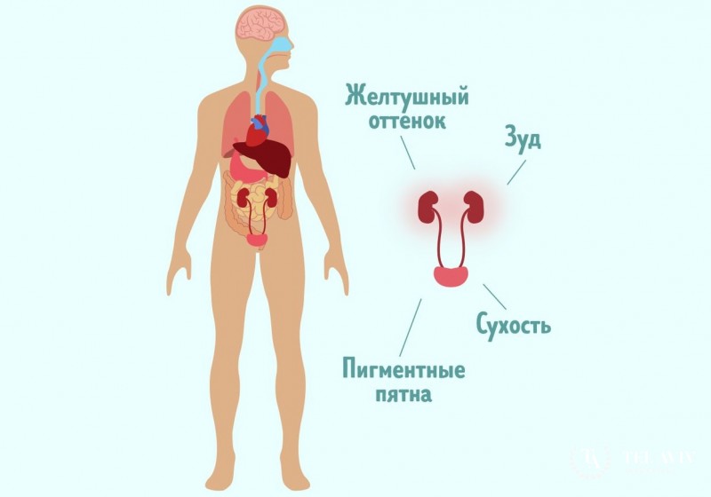 Симптомы заболеваний почек