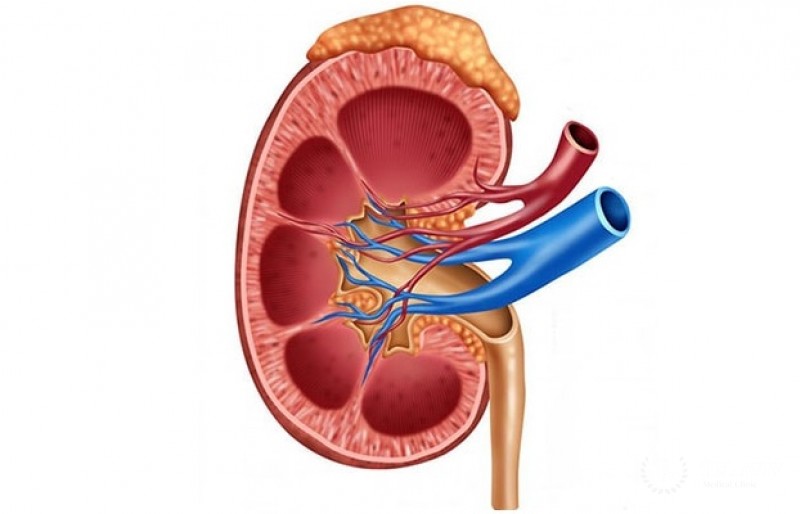 Пигментная аденома