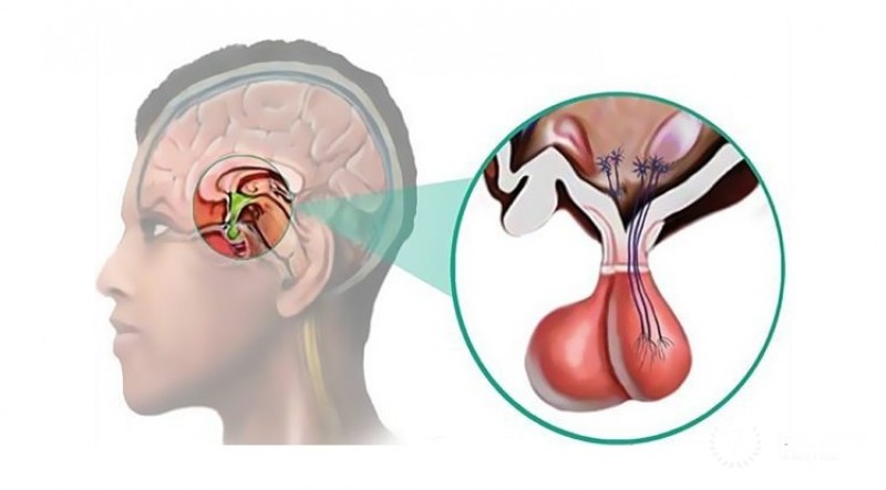 Пролактинома: информация