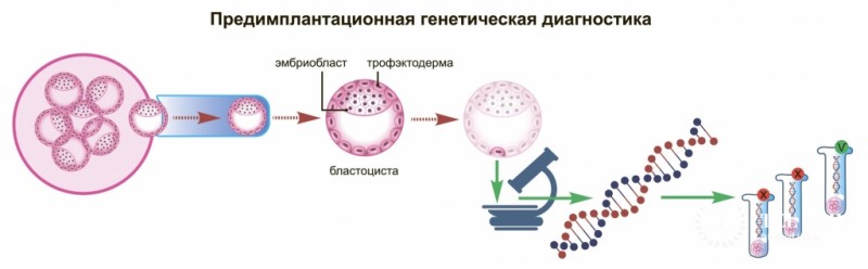 Генетический скрининг (мутации RET-онкогена)