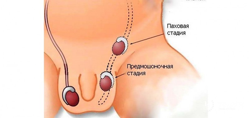 Врожденные аномалии: разновидности, диагностика