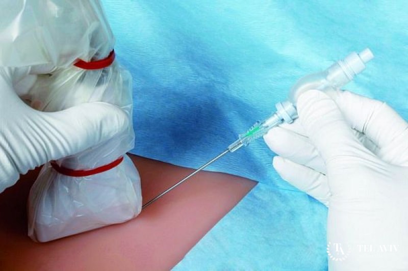 Пункция молочной железы: информация