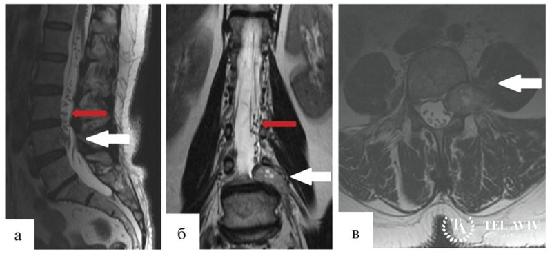 Сосудистые образования (эндотелиоцитарные и периваскулярные): общая информация