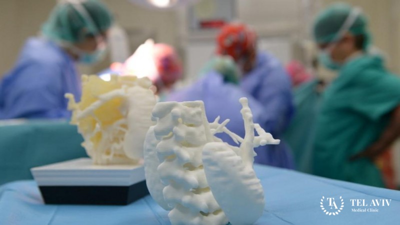 3D-печать в хирургии: полная информация