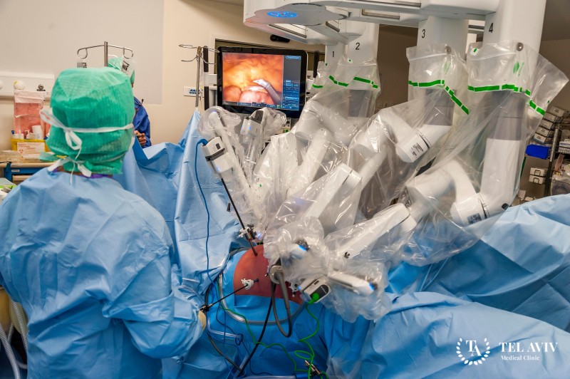 Robotic Surgery for Liver Cancer