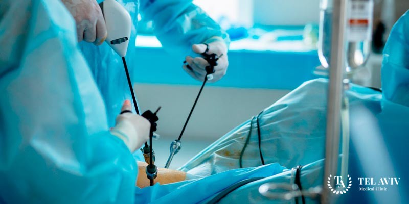 Laparoscopic nephrectomy for organ transplant