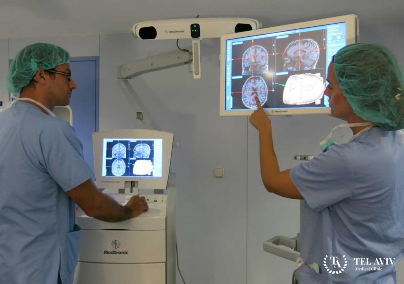 Desmoplastic Small Round Cell Tumors (DSRCT) Diagnosis