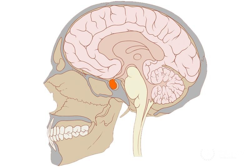 Смешаная ацедобазофильная аденома гипофиза – особенности, диагностика