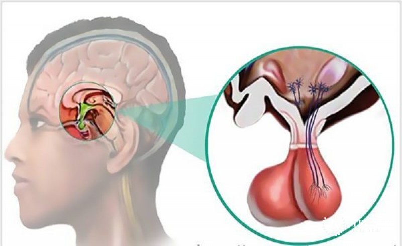 Пролактинома – описание, диагностика, лечение